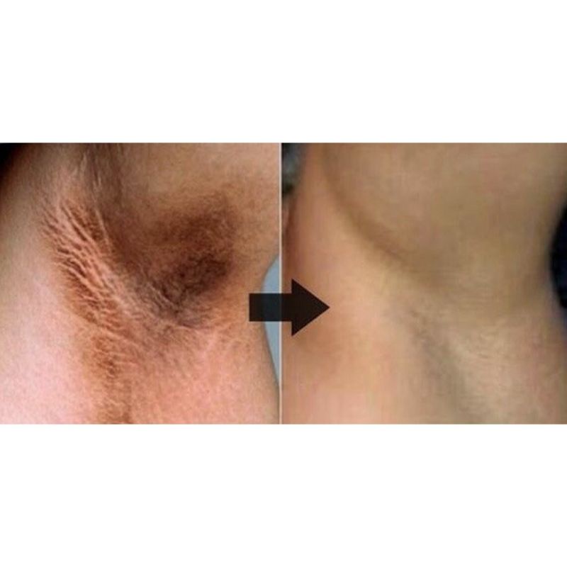 87a072bebd330425ff10514073144579