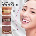 sg-11134201-22110-tn9qa4wuufkv62