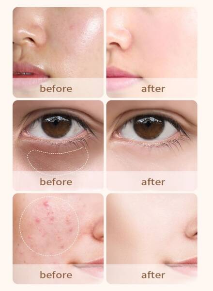 sg-11134202-23010-m7ea92mojvlvab